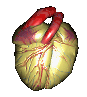 Ataque Cardíaco ou Infarto do Miocárdio